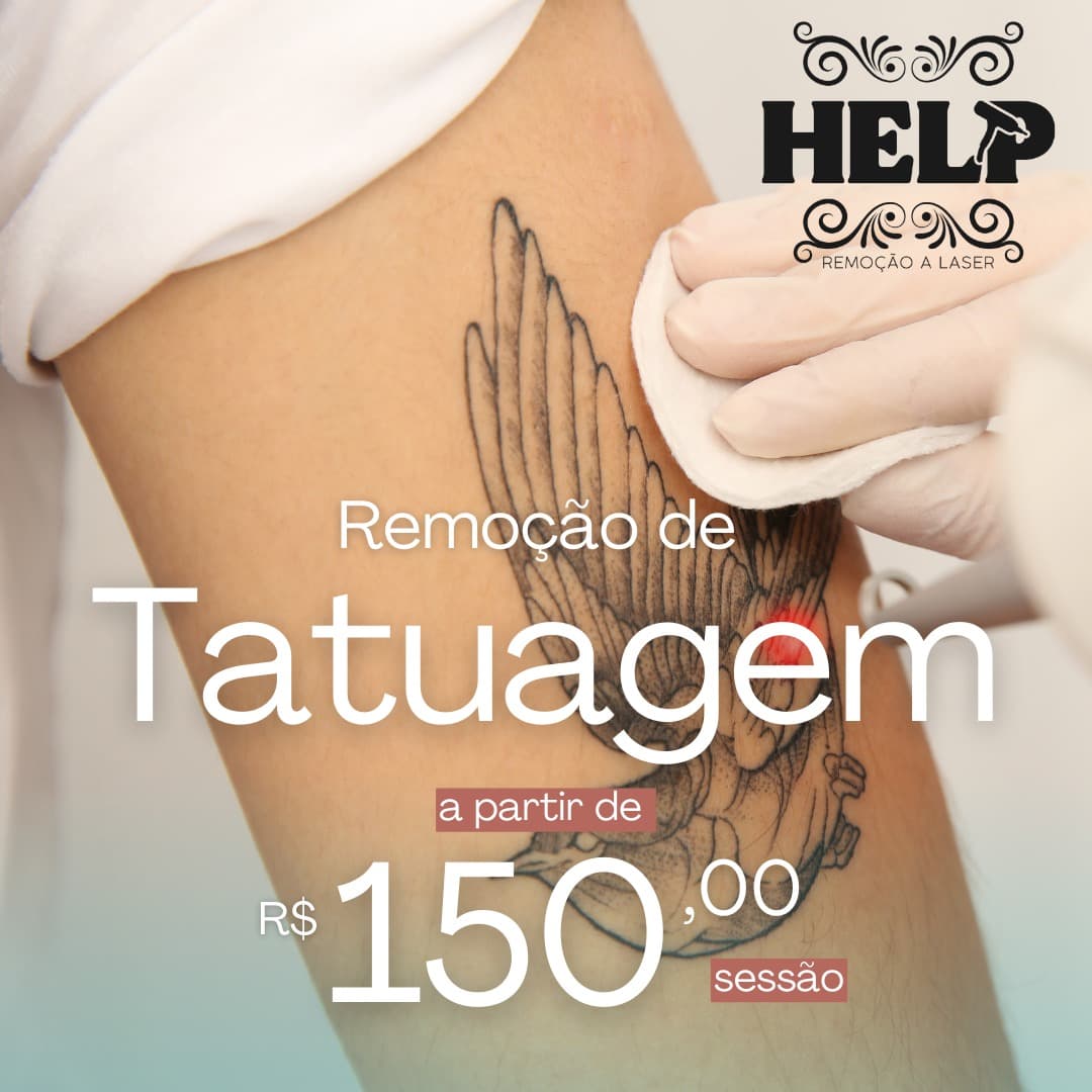 remoção-de-tatuagem-curitiba